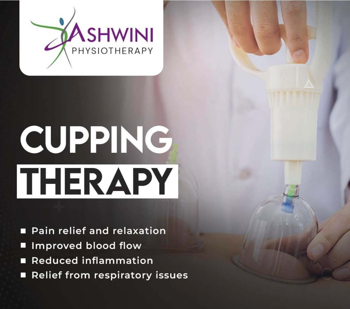 Cupping Therapy