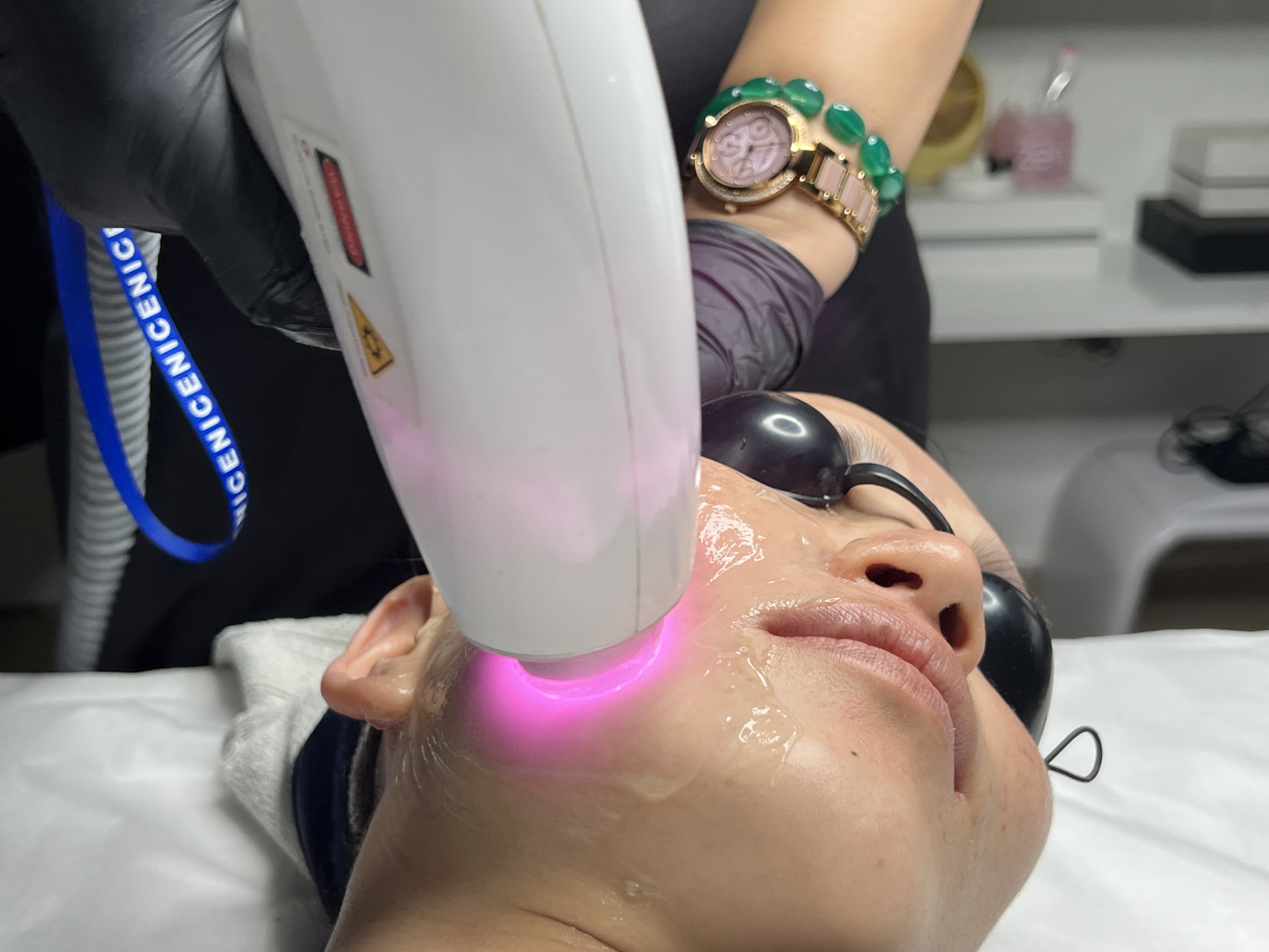 CINDERELLA SKIN TREATMENT