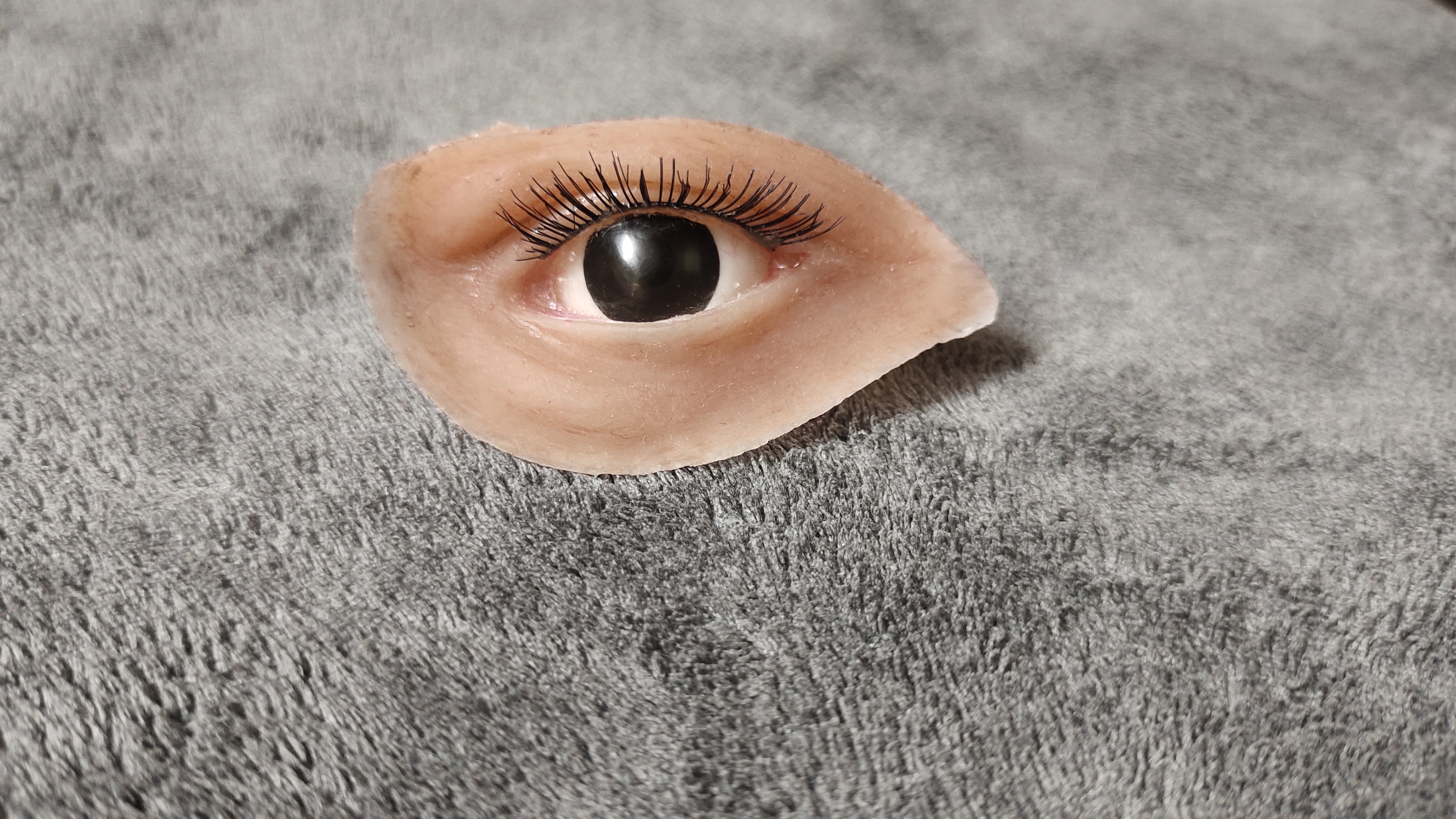 Artificial Eye Prosthesis