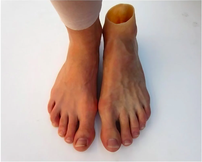 Artificial Foot