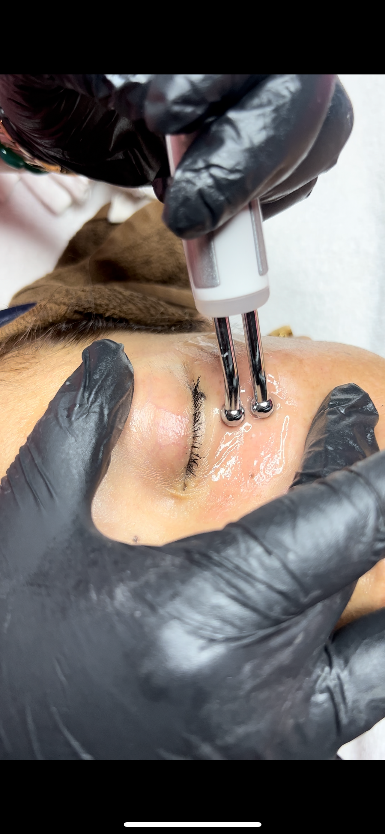 NO NEEDLE SKIN BOOSTER TREATMENT
