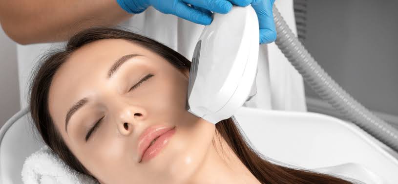 Photofacial  Treatment