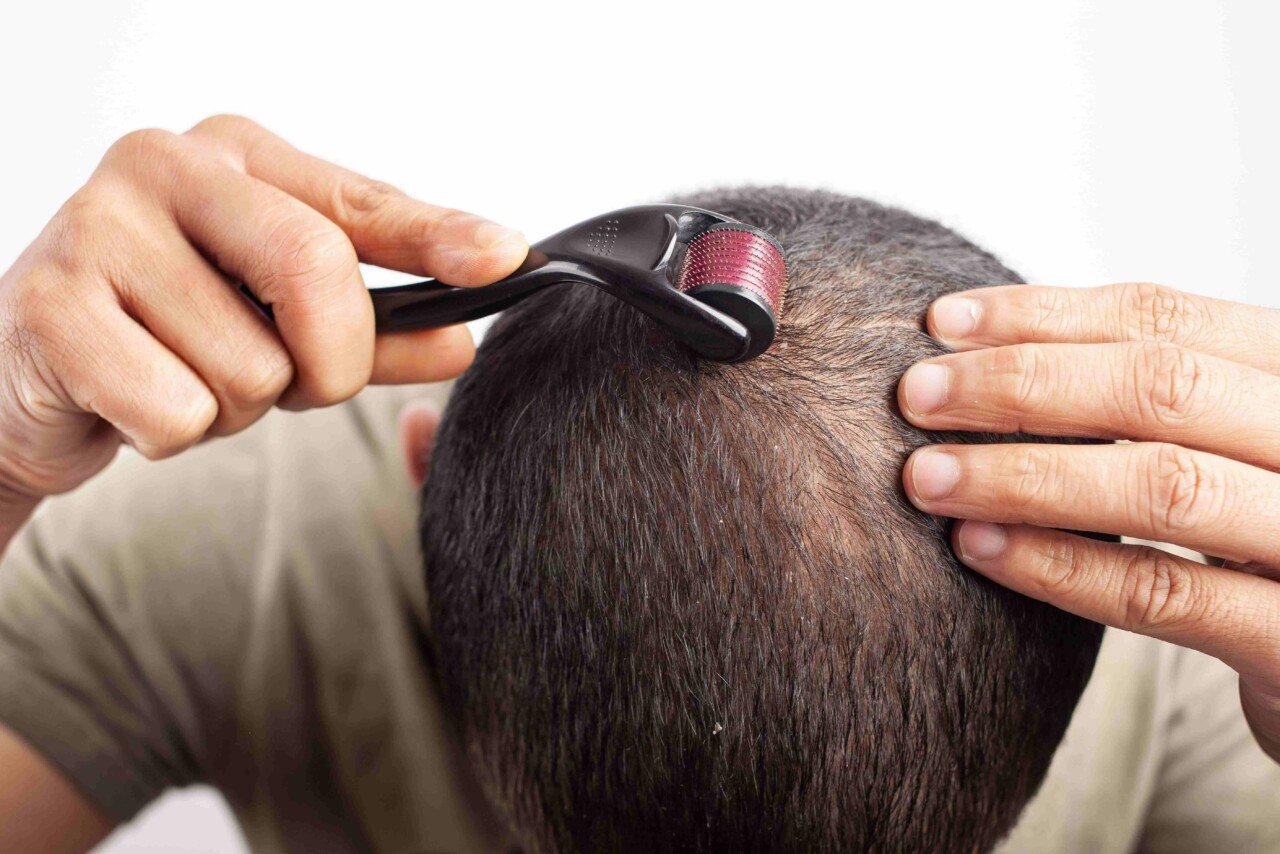 SCALP DERMAROLLER THERAPY