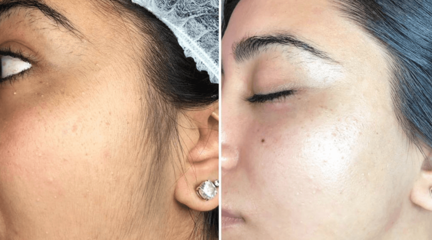 DERMA CLEANUP