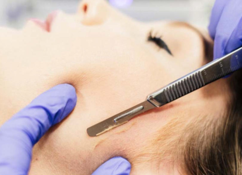 DERMA PLANNING FACIAL