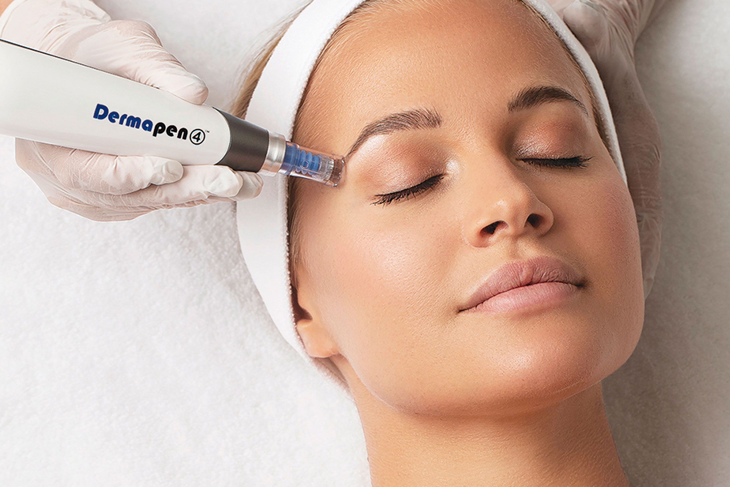 DERMAPEN MICRONEEDLING
