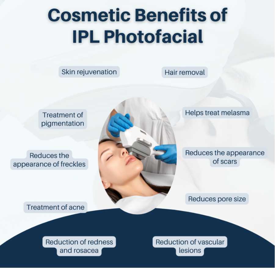 INTENSE PULSE LIGHT (IPL) SKIN REJUVENATION
