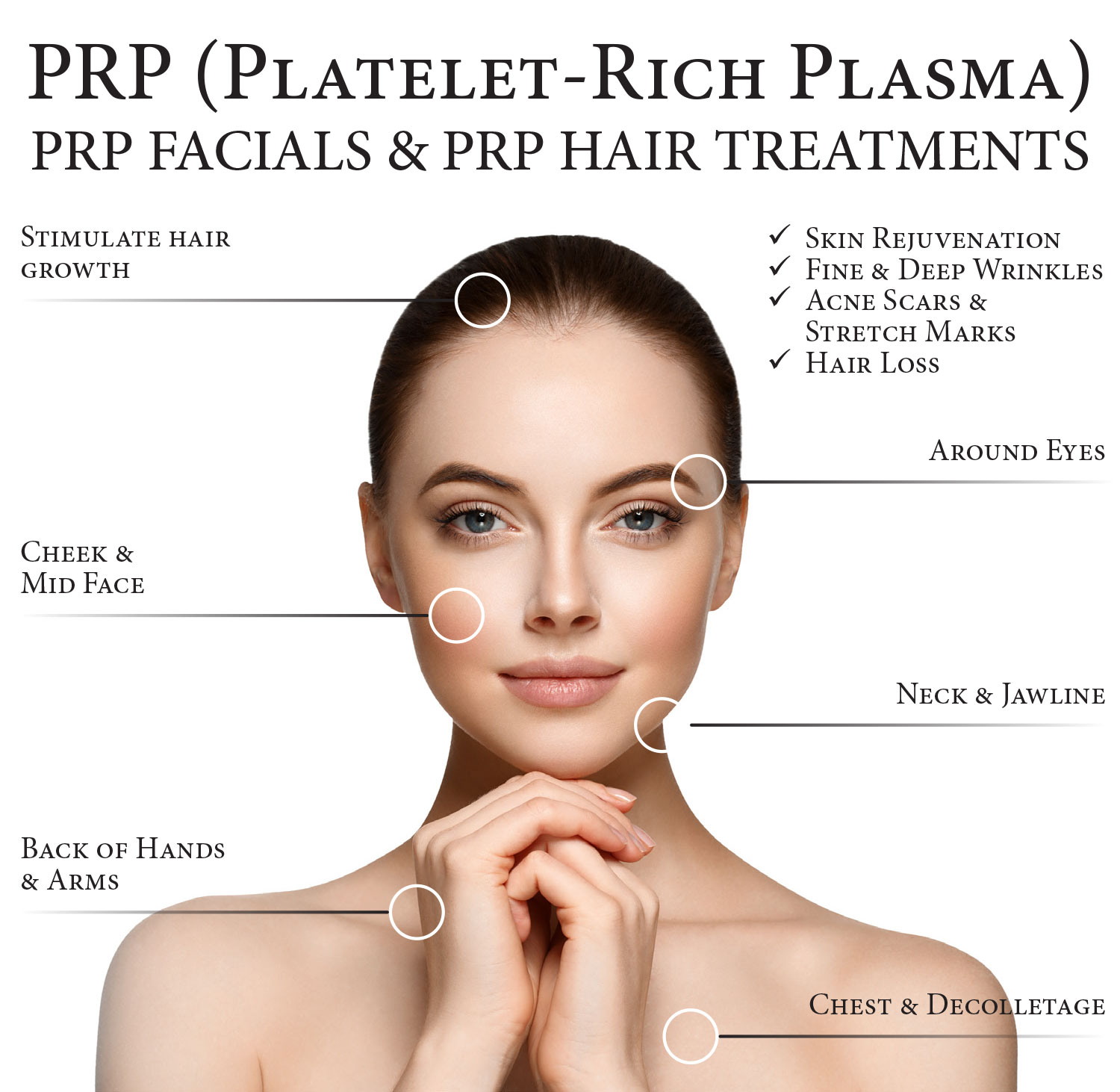 PRP (PLATELET-RICH PLASMA)