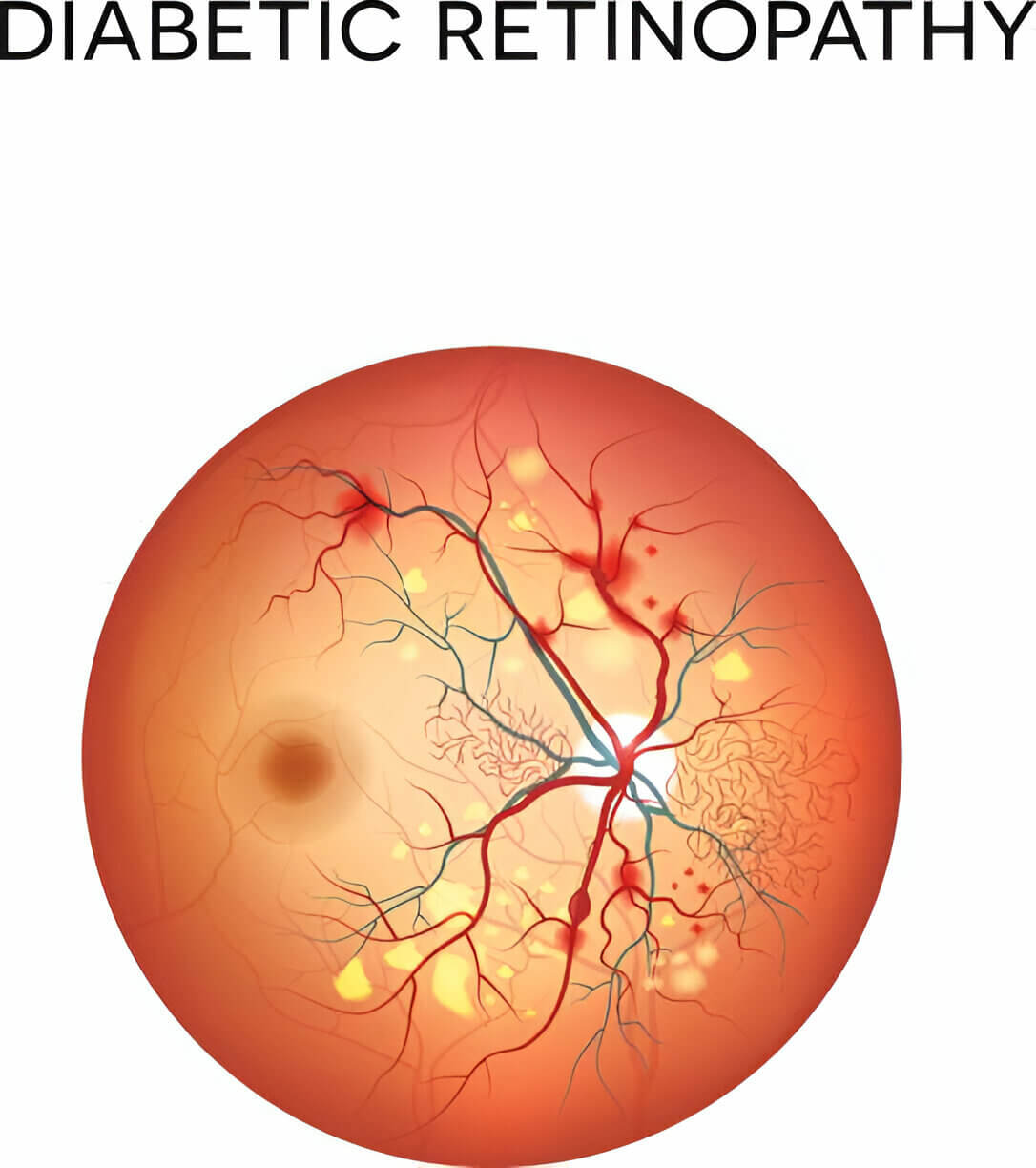 Retina