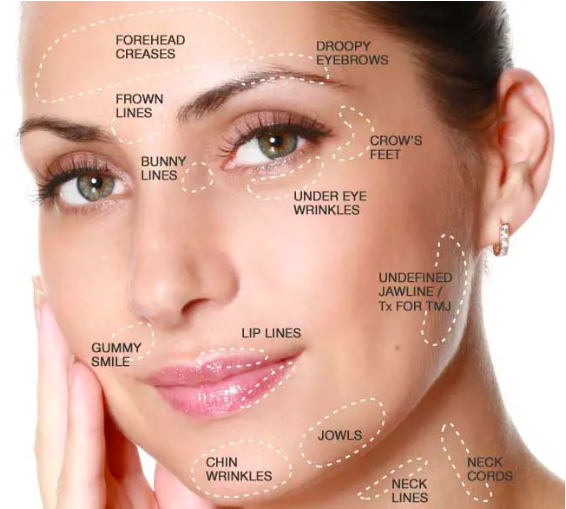 Botulinum Toxin