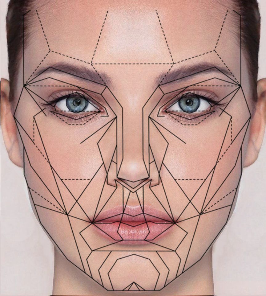 Facial Implants