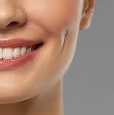 Dimple Creation