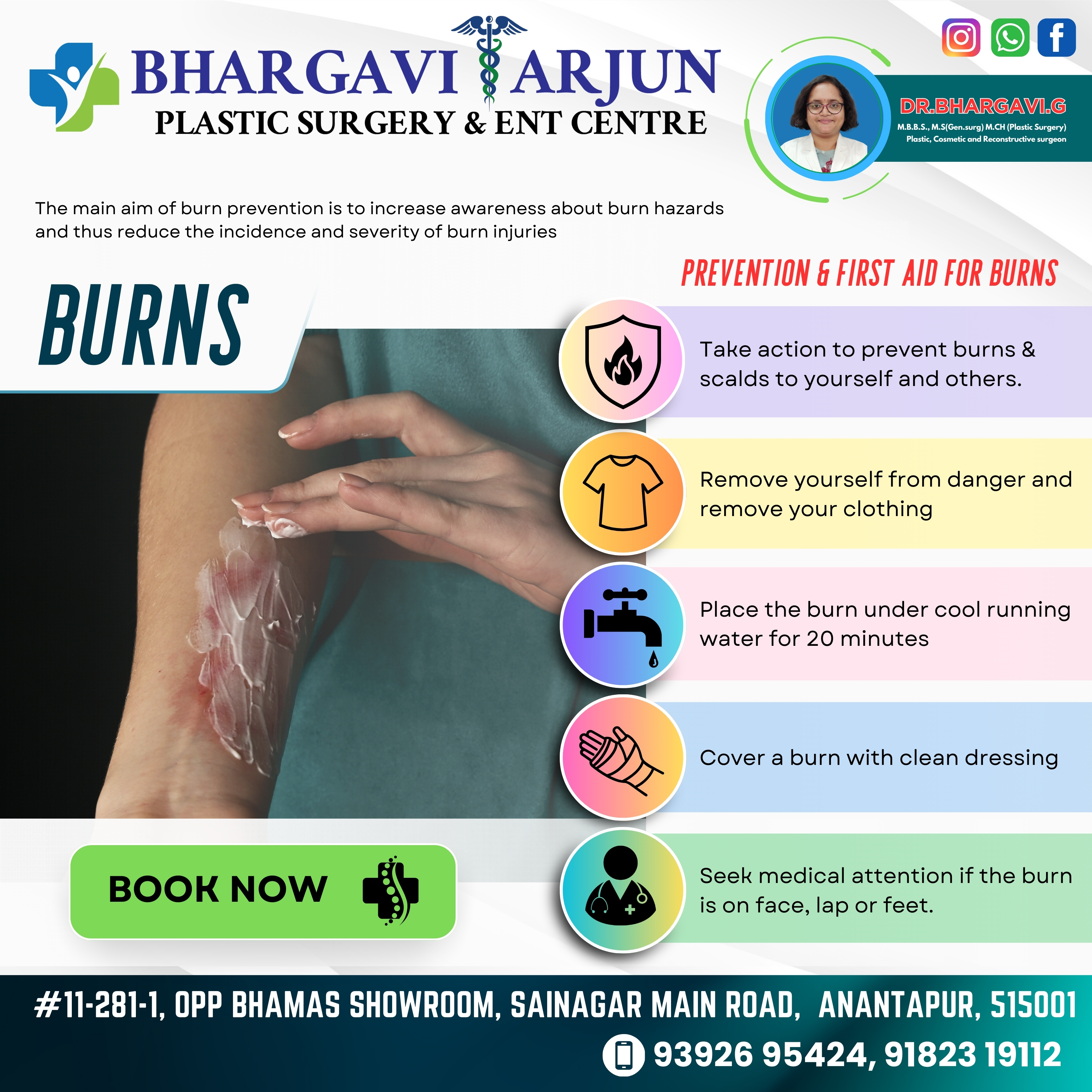 Burns