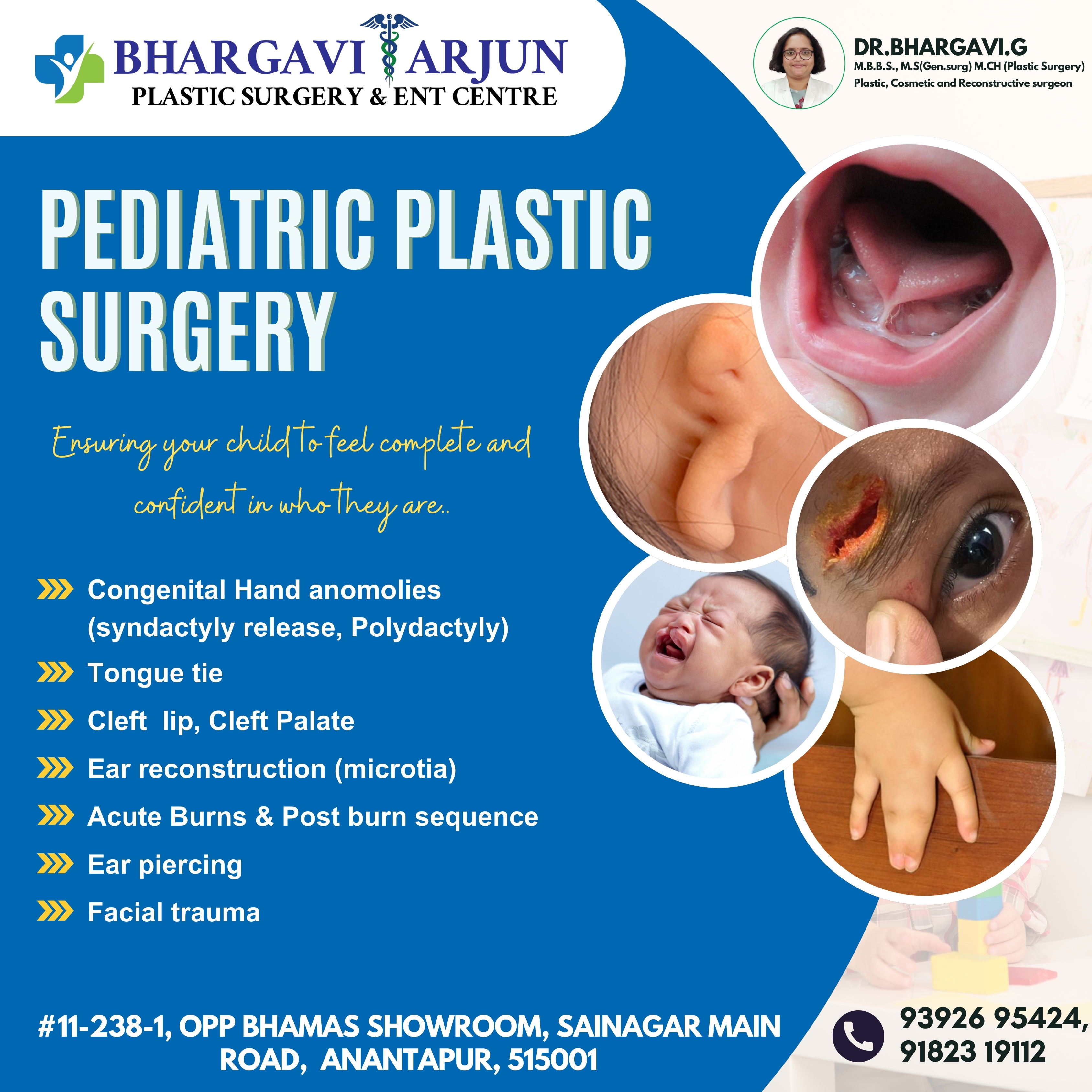 Pediatric plastic surgery