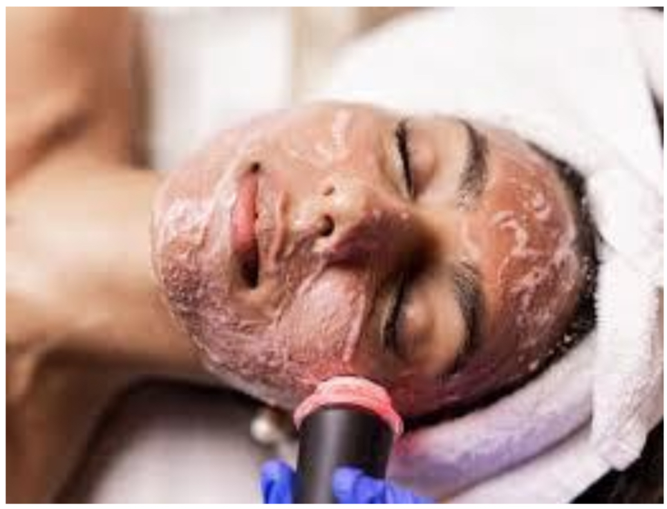 Oxygeneo Facial
