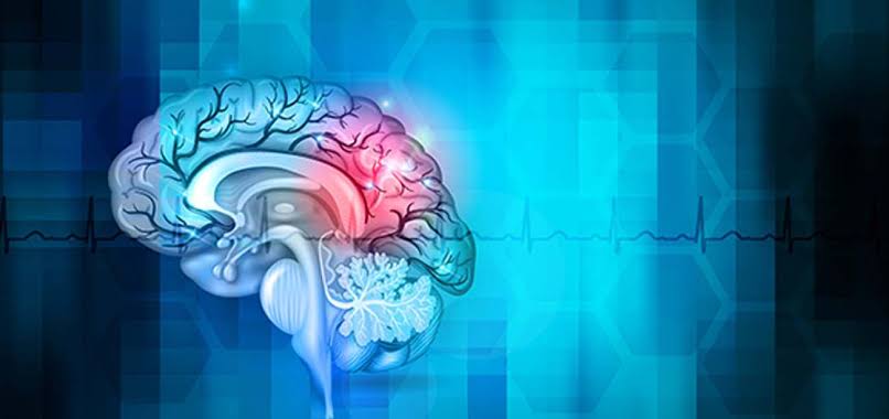 Cerebrovascular & Endovascular Neurosurgery