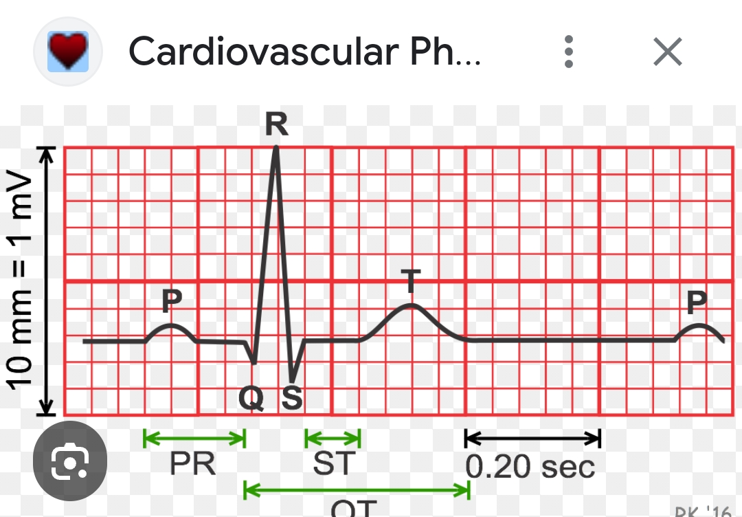 ECG