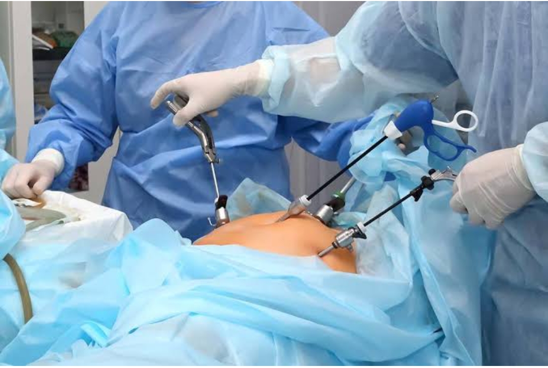Laproscopic and Endoscopic surgery