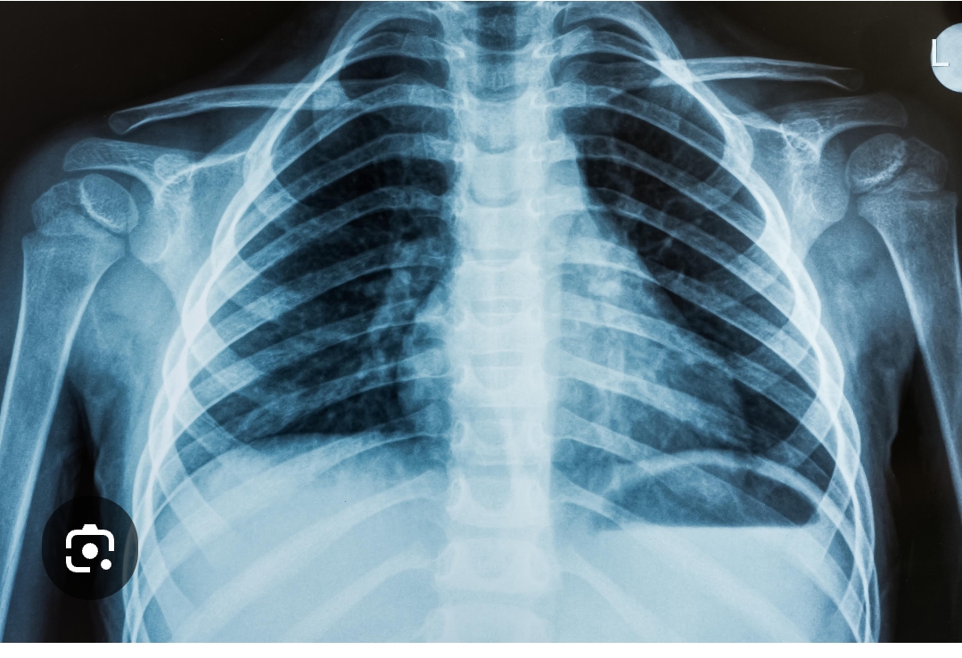 X Ray
