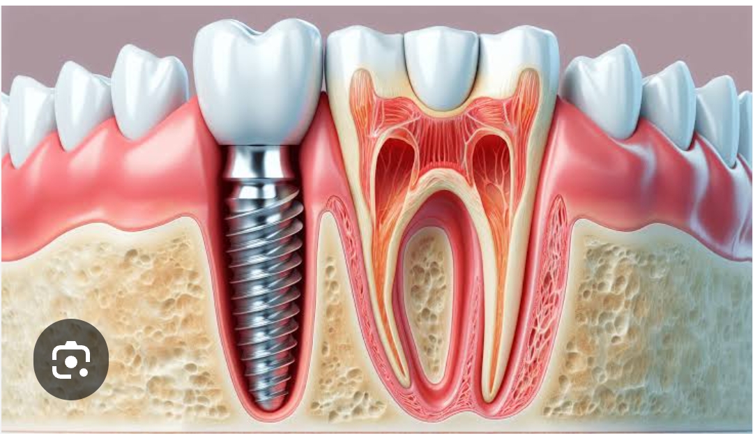 Dental clinic and implant