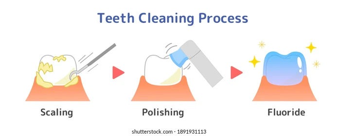 Scaling And Polishng