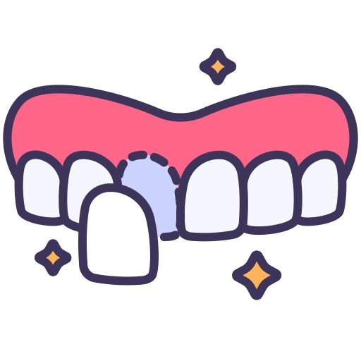 Veneers