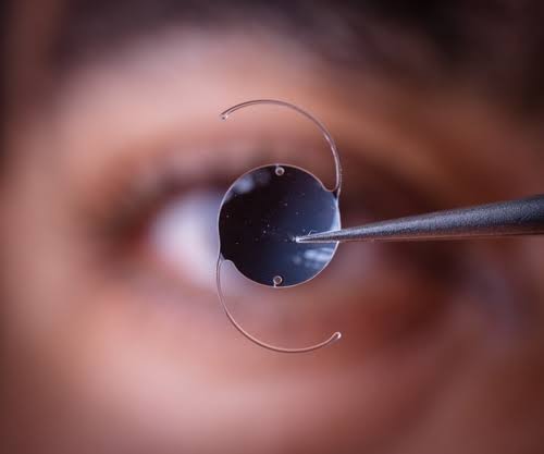 Premium Foldable Intraocular Lens (IOL) Implantation