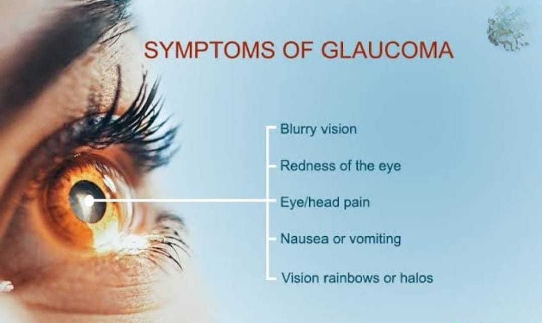 Glaucoma Services