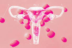 PCOS and Hormonal Health