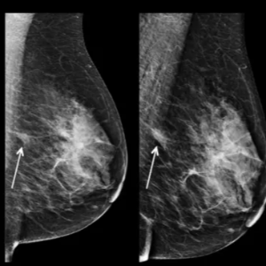 Cancer Imaging Review