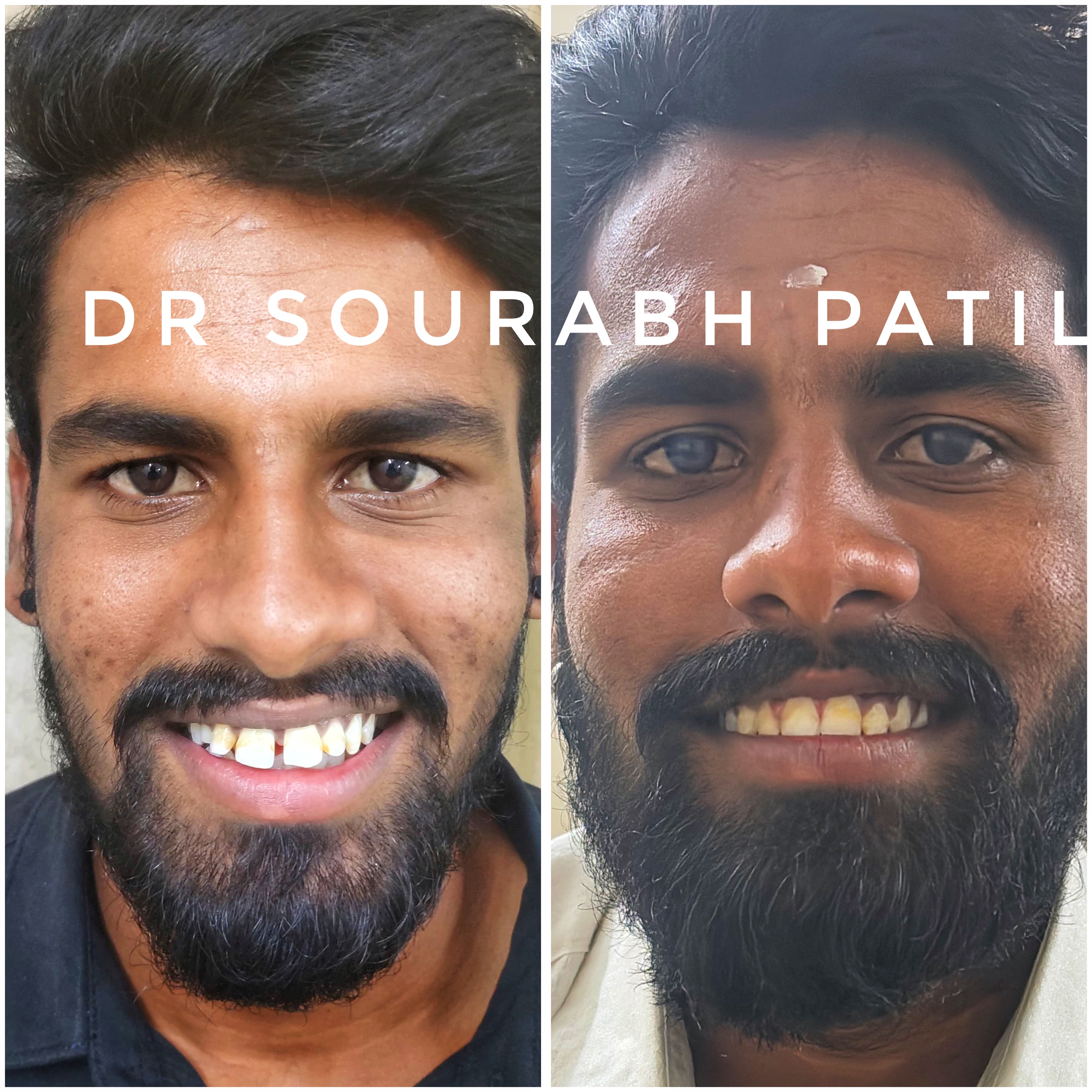 Orthodontic treatment