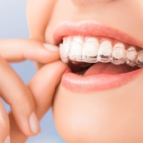 ORTHODONTIC CARE