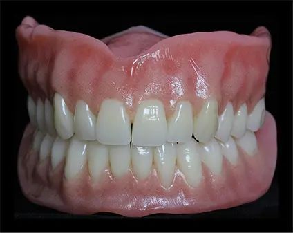 DENTURES