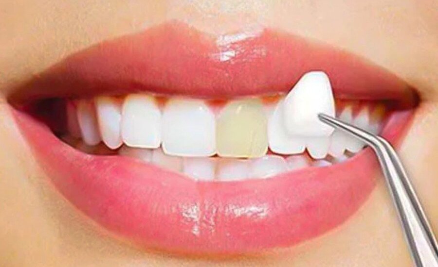 COSMETIC DENTISTRY