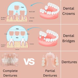CROWNS,  BRIDGES AND DENTURES