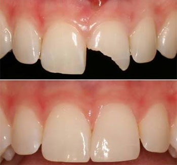 COSMETIC DENTISTRY