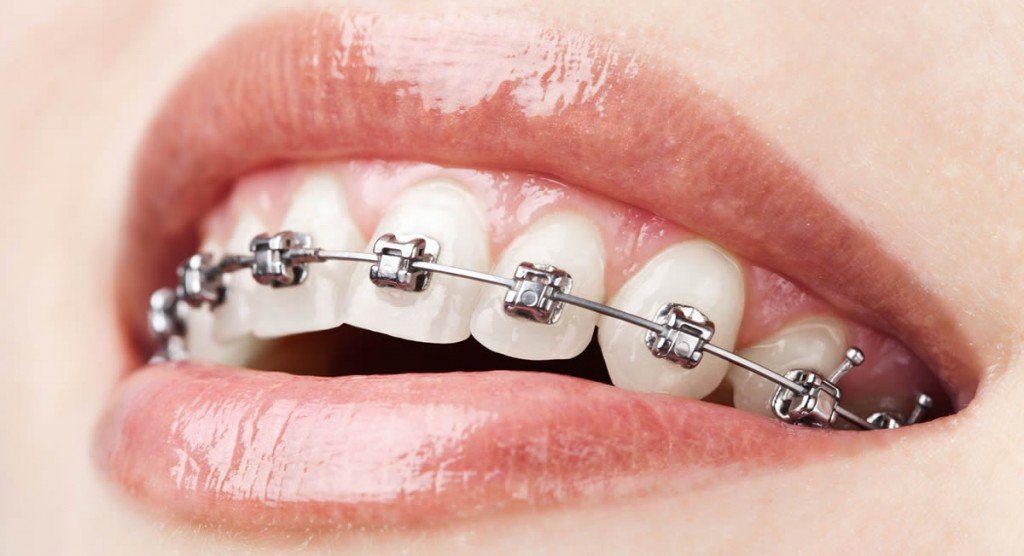 ORTHODONTICS