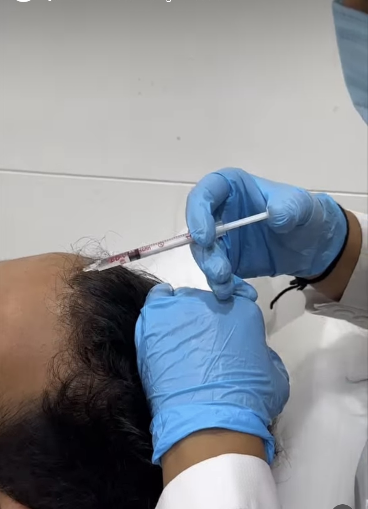 Hair advance exosome