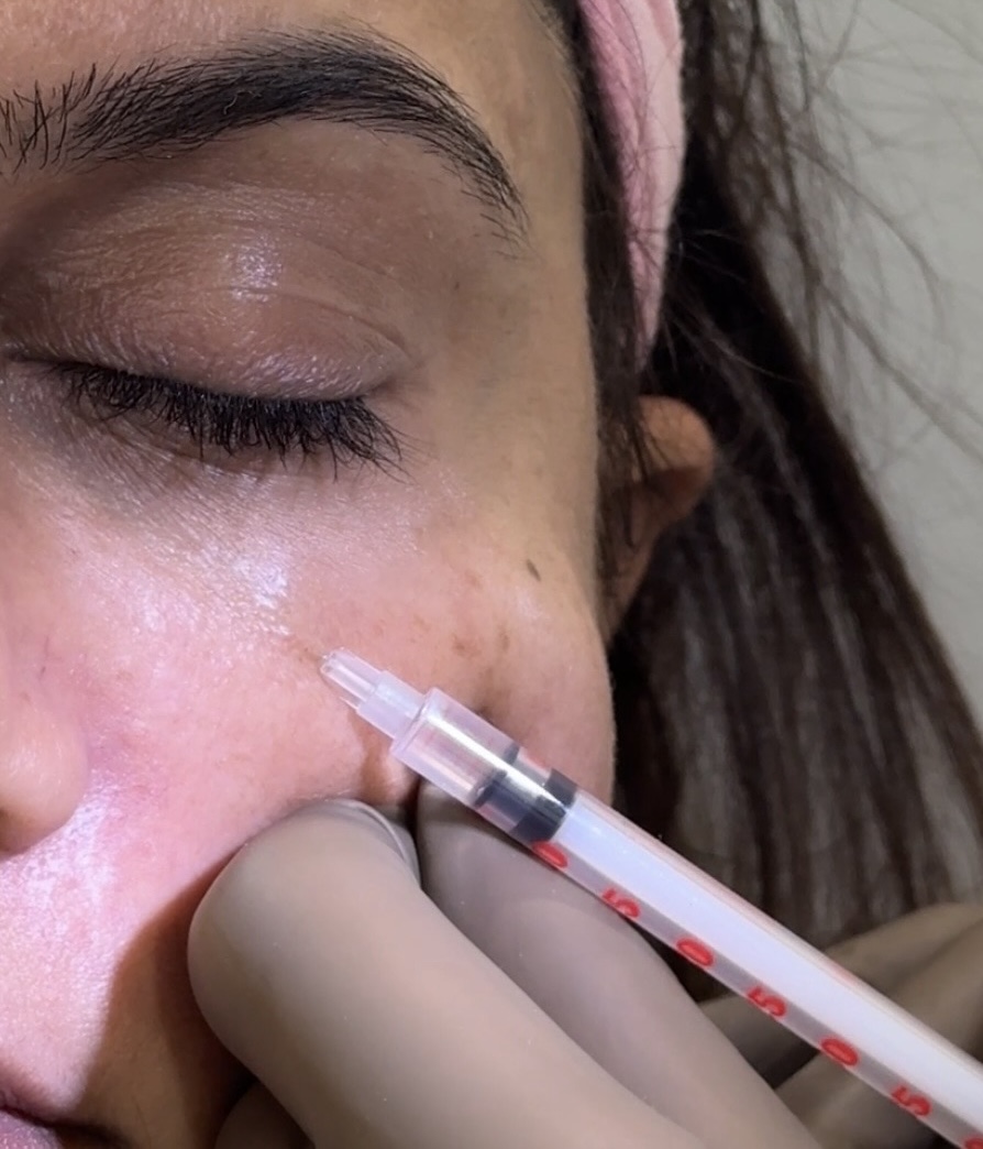 Polynucleotide treatment