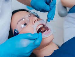 Root Canal