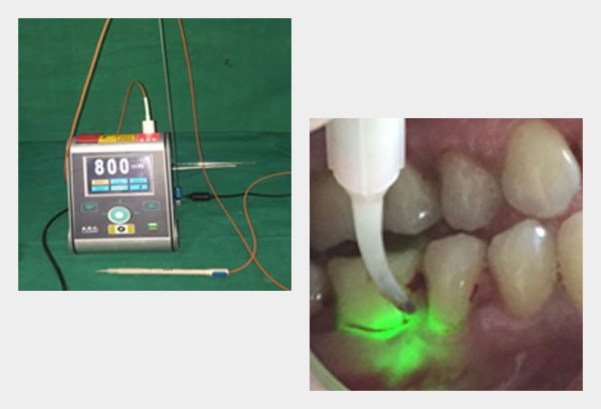 Laser dentistry
