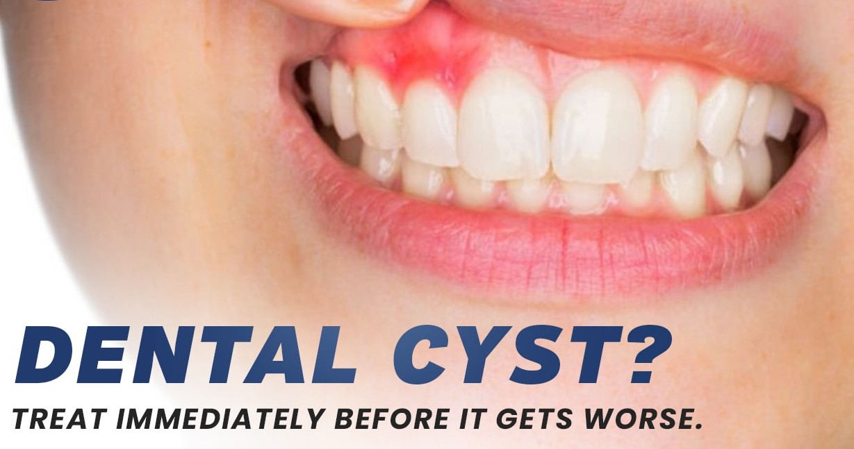 Cyst and Tumor removal