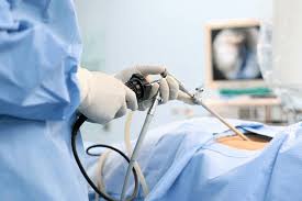 Laparoscopy