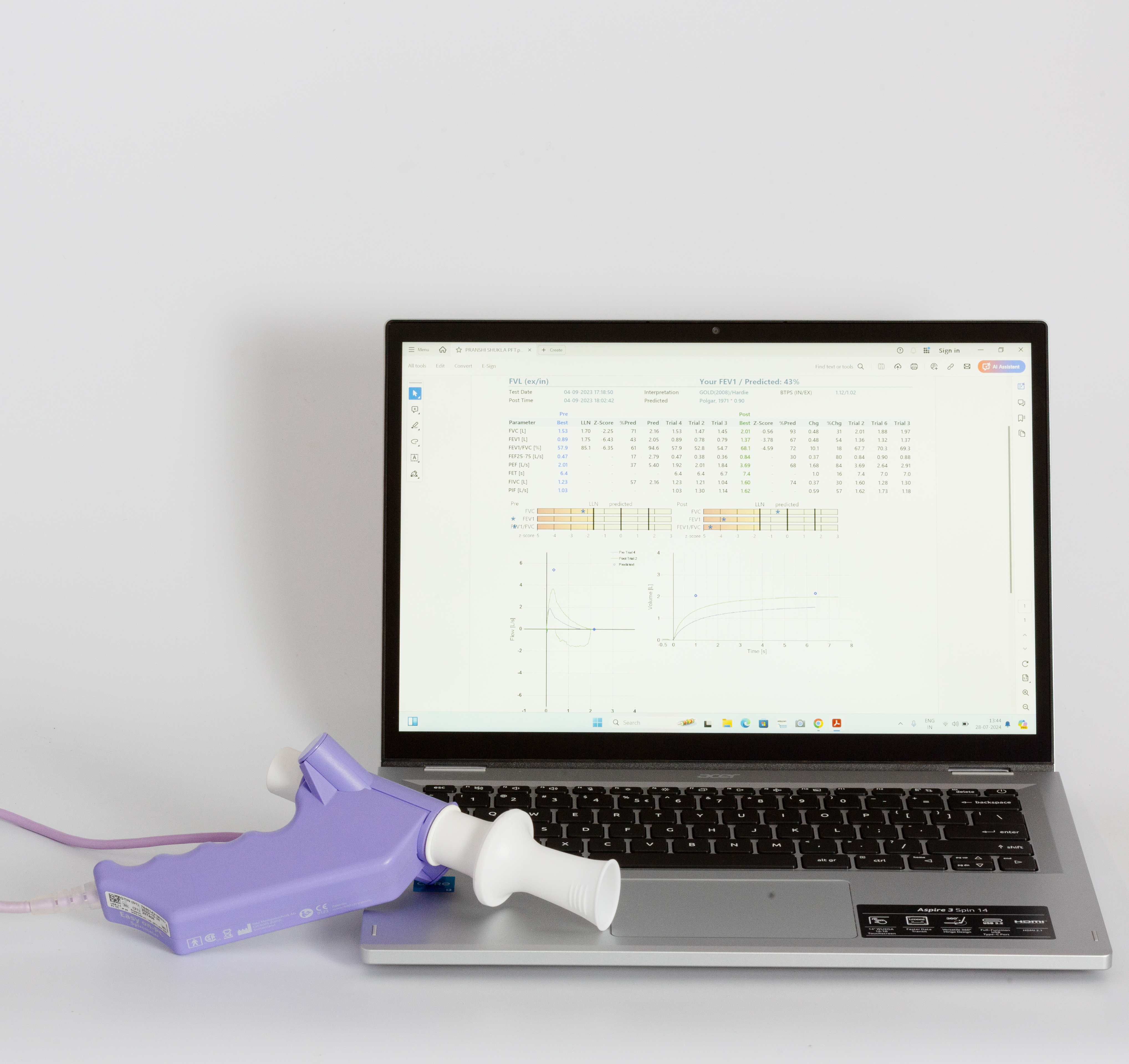 Spirometry(lung function)