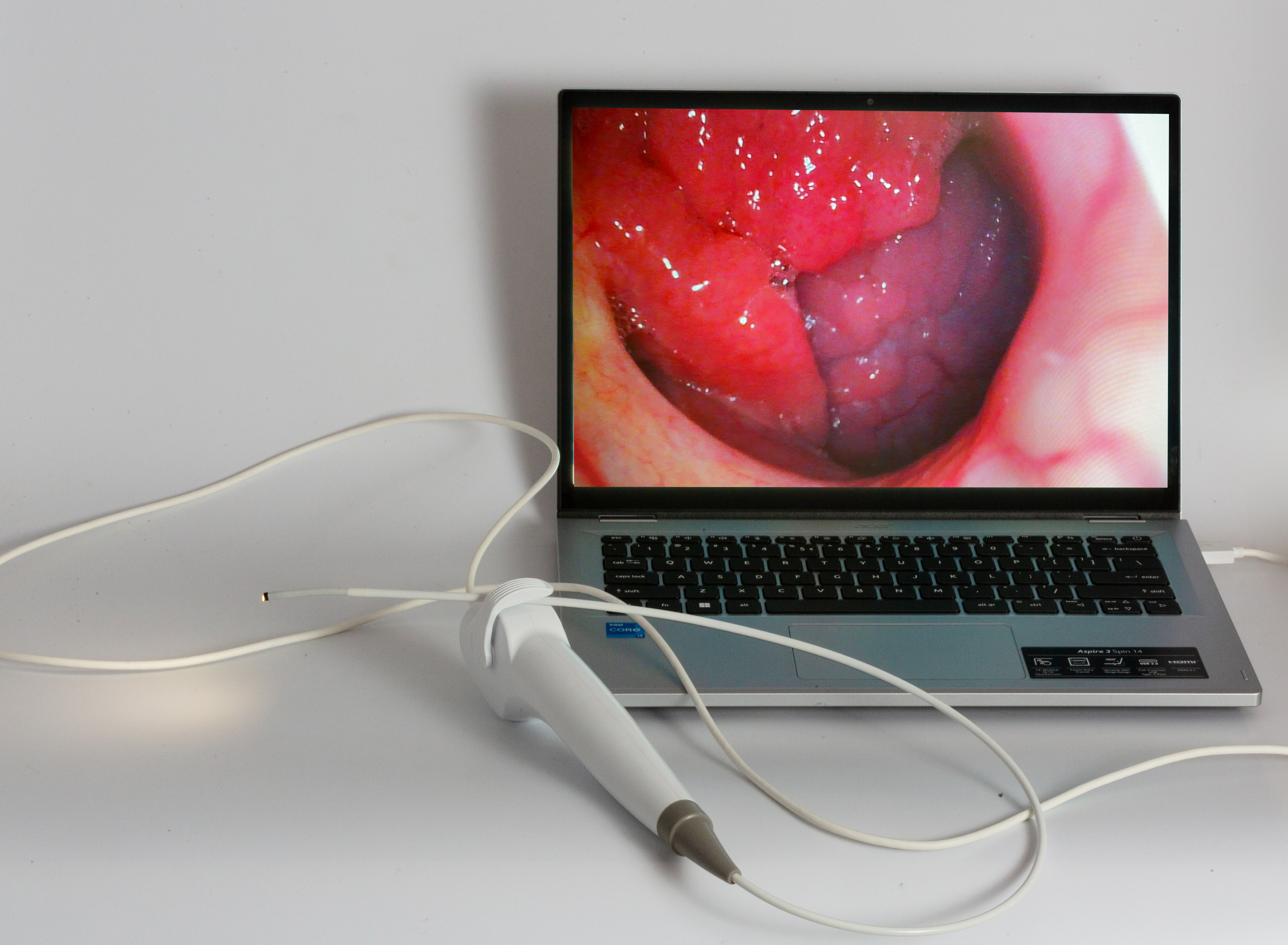 Nasal endoscopy