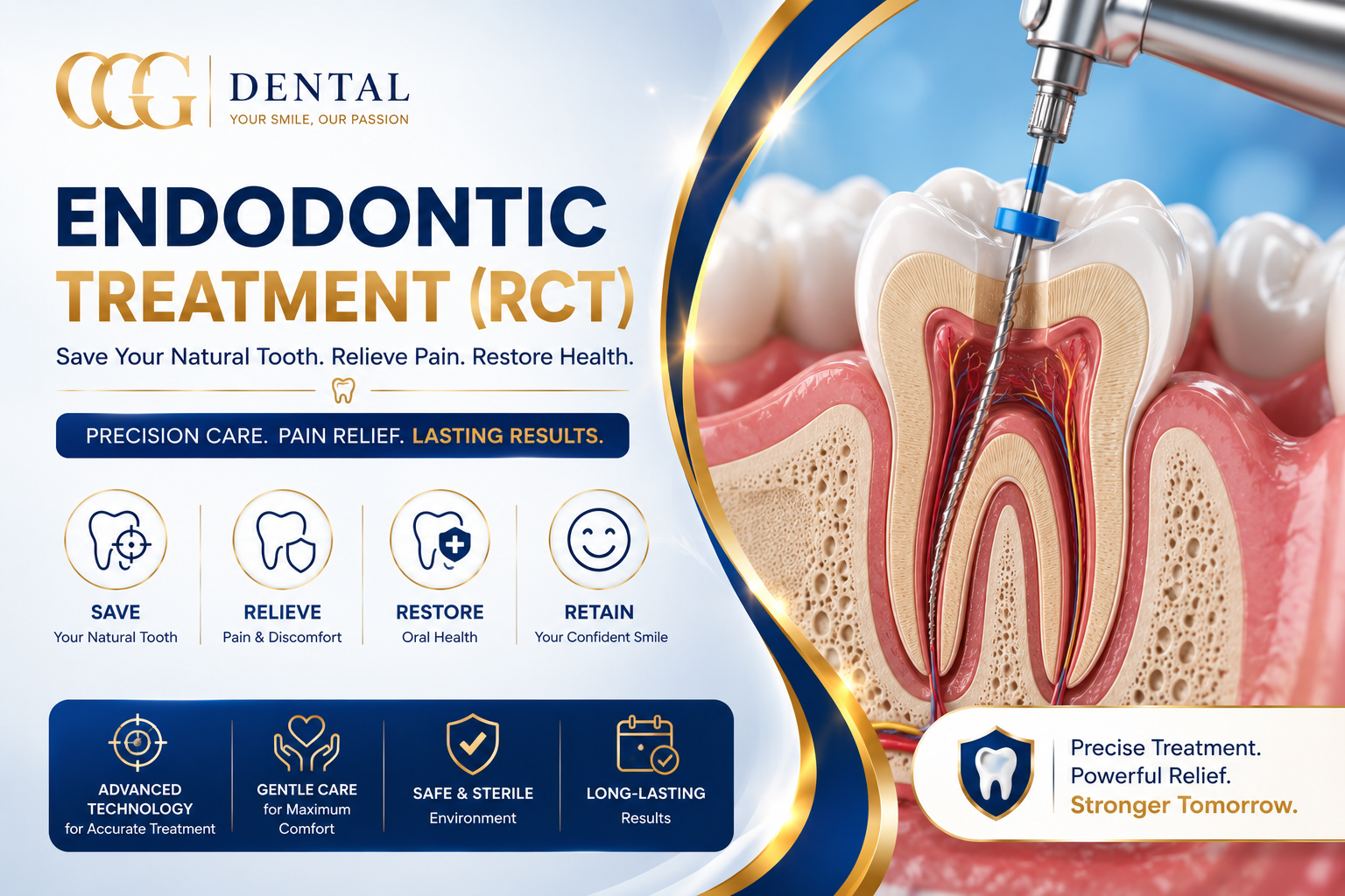 Endodontic Treatment