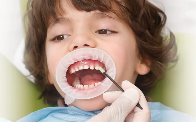 Preventive and Prophylactic Dentistry
