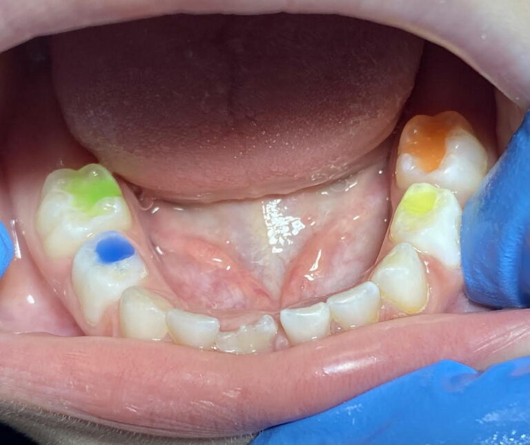 Restorative Dentistry
