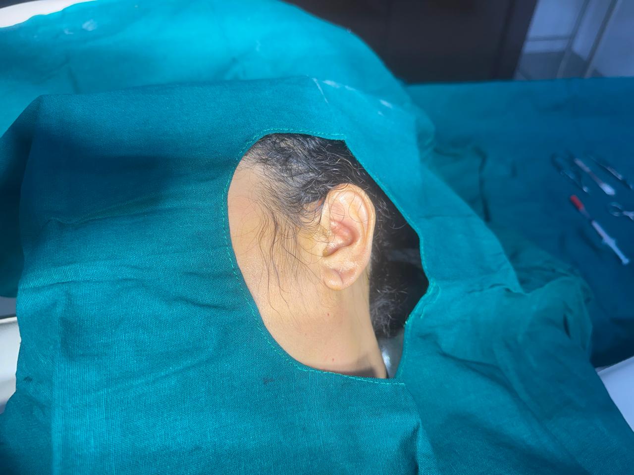 EAR LOBE REPAIR