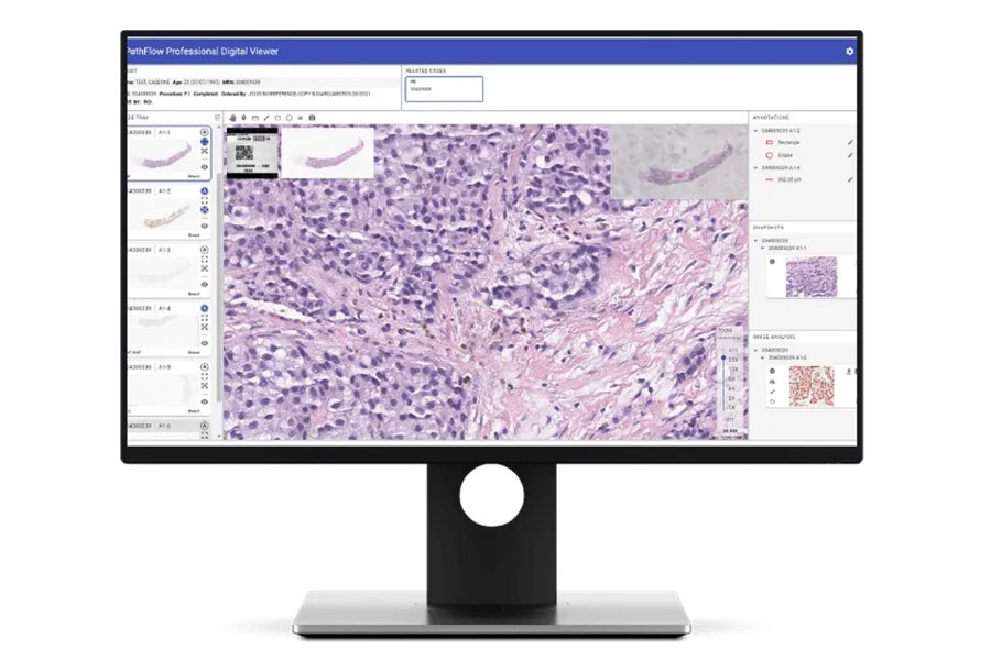 Second opinion Dermatopathology Consultation